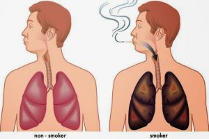 smettere-di-fumare-effetti-collaterali